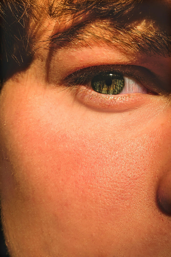 How do I know if my skin barrier is damaged?