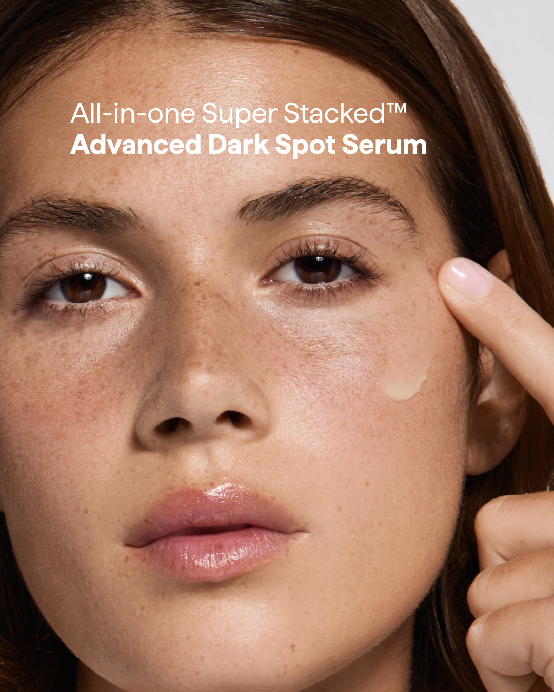 Remedy for Dark Spots – Discoloration Treatment with Retinol