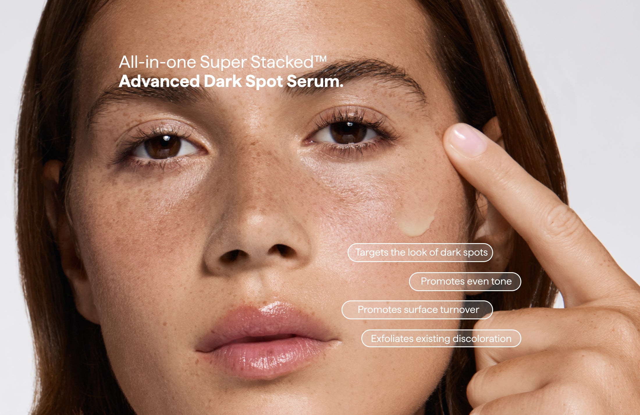 Remedy for Dark Spots | Advanced Dark Spot Serum with Kojic Acid