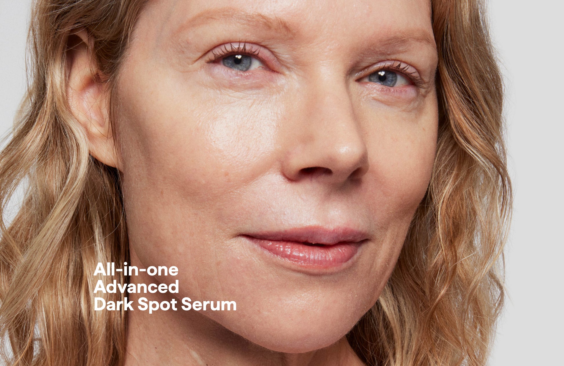 REMEDY for dark spots